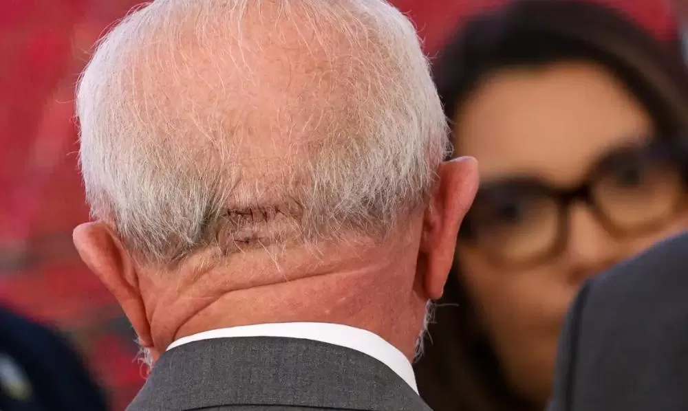 Presidente Lula faz exames em Brasília e apresenta quadro estável 